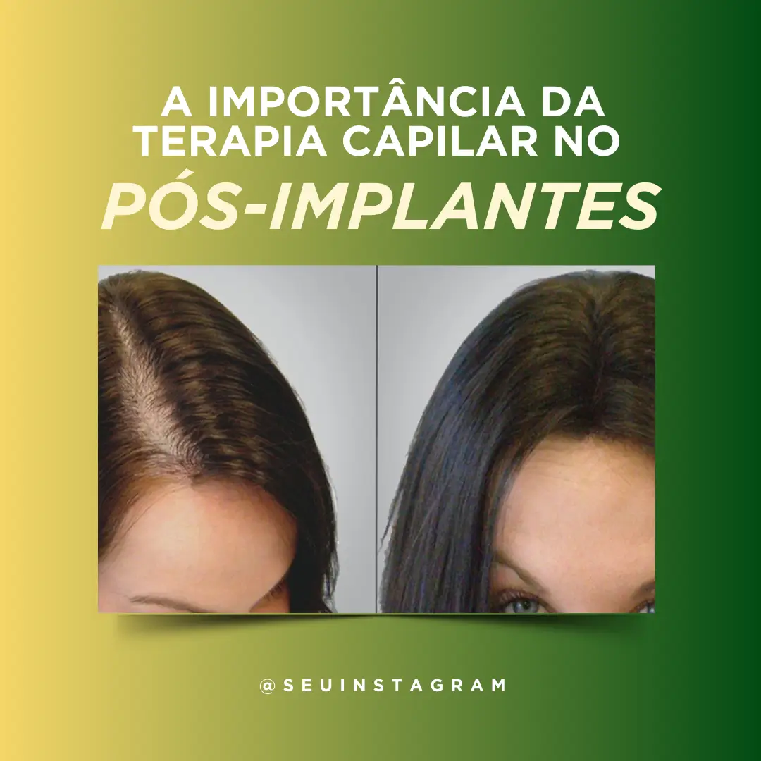 Posts para terapia capilar (15)