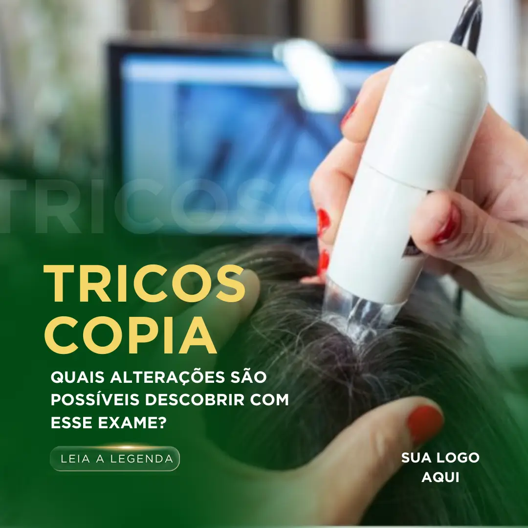 Posts para terapia capilar (2)