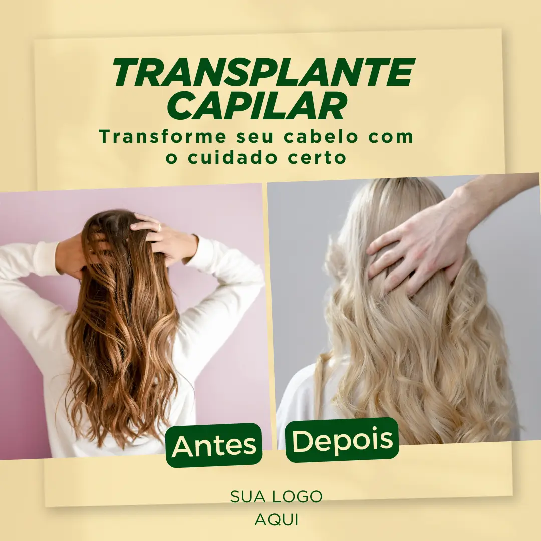 Posts para terapia capilar (3)