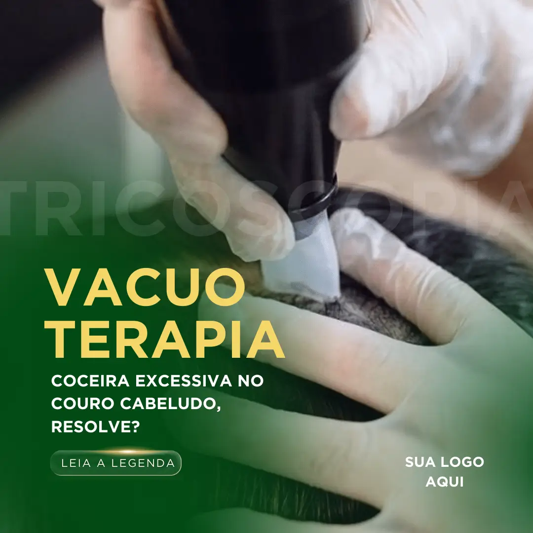 Posts para terapia capilar (8)